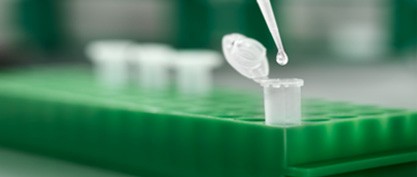 Optimize Your Immunoprecipitation (IP) with ChromoTek Nano-Traps